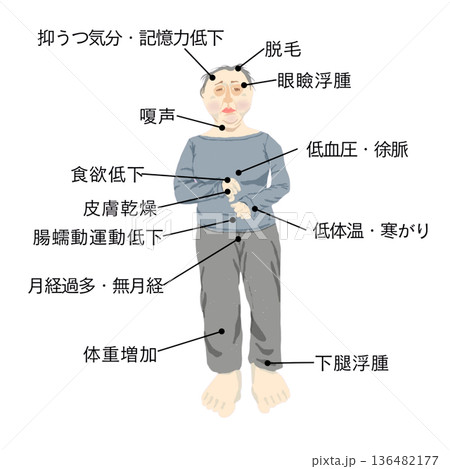 甲状腺機能低下症の症状イメージ 浮腫・寒がり・抑うつ気分など全身症状を示す女性の医療イラスト 甲状腺機能低下症の症状イメージ 浮腫・寒がり・抑うつ気分など全身症状を示す女性の医療イラスト 136482177