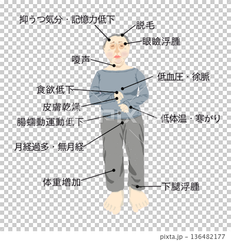 甲状腺機能低下症の症状イメージ 浮腫・寒がり・抑うつ気分など全身症状を示す女性の医療イラスト 甲状腺機能低下症の症状イメージ 浮腫・寒がり・抑うつ気分など全身症状を示す女性の医療イラスト 136482177