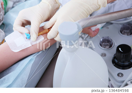 An intravenous catheter is inserted into the child's arm. The child is under anesthesia. The concept of healthcare and medicine. An intravenous catheter is inserted into the child's arm. The child is under anesthesia. The concept of healthcare and medicine. 136484598