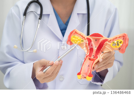 Uterus, doctor holding human anatomy model for study diagnosis and treatment in hospital. Uterus, doctor holding human anatomy model for study diagnosis and treatment in hospital. 136486468