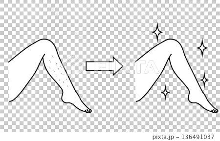脚の脱毛　ビフォーアフターイラスト	 136491037