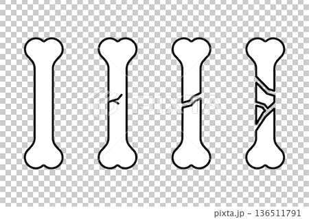 A set of bone icons showing various fractures 136511791