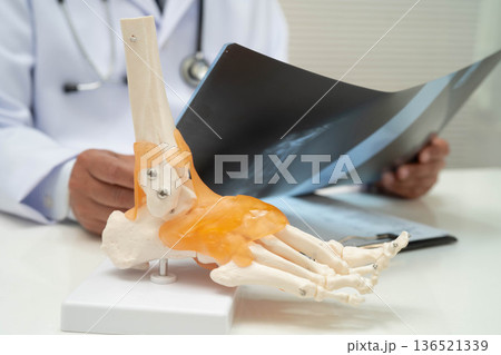 Doctor examining foot ankle joint bone radiography xray film. Doctor examining foot ankle joint bone radiography xray film. 136521339