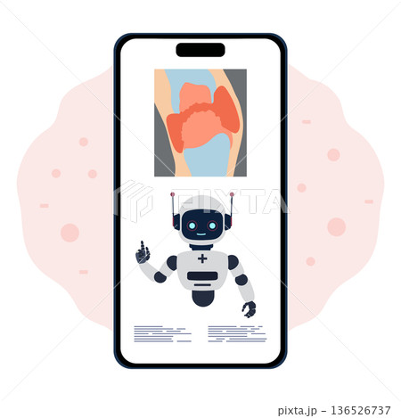 Medical AI robot on smartphone screen with anatomical knee illustration in background 136526737