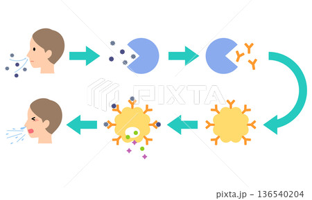 アレルギー発症のしくみ 花粉症のメカニズム アレルギー発症のしくみ 花粉症のメカニズム 136540204