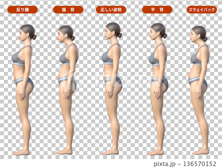 Comparison of postures: Swayback, arched back, forward tilt of the pelvis, hunchback, flat back, correct posture illustration, whole body sideways 136570152