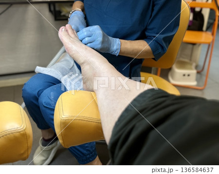 Hardware medical pedicure using a drill and nail files. A patient has a pedicure at a podiatrist. A dangerous fungal lesion of human toenails. Onychomycosis, treatment of nail fungus. Hardware medical pedicure using a drill and nail files. A patient has a pedicure at a podiatrist. A dangerous fungal lesion of human toenails. Onychomycosis, treatment of nail fungus. 136584637