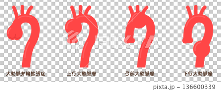 大動脈弁輪拡張症と大動脈瘤 annuloaortic ectasia&aortic aneurysm 136600339