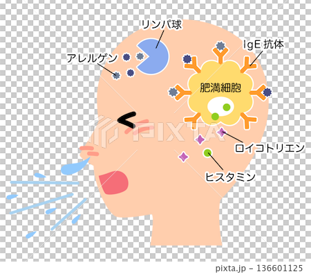 How allergies develop: The mechanism of hay fever How allergies develop: The mechanism of hay fever 136601125