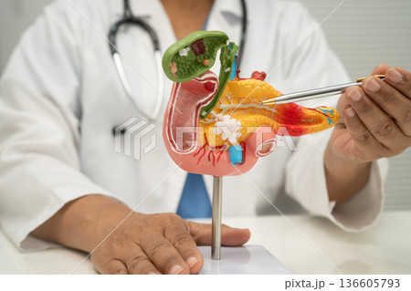 Pancreatitis, pancreatic cancer, Asian doctor with pancreas, gallbladder and bile duct human anatomy model at hospital. Pancreatitis, pancreatic cancer, Asian doctor with pancreas, gallbladder and bile duct human anatomy model at hospital. 136605793