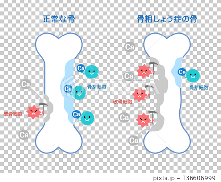 Mechanisms of bone resorption and bone formation: Normal bones and osteoporotic bones Mechanisms of bone resorption and bone formation: Normal bones and osteoporotic bones 136606999