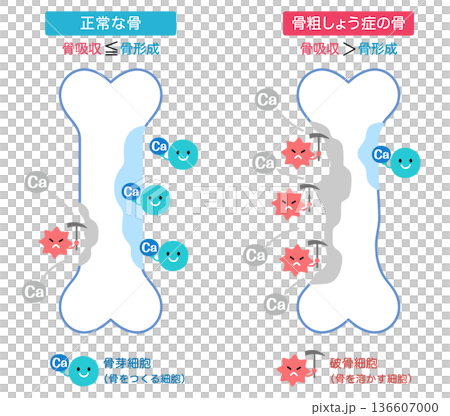Mechanisms of bone resorption and bone formation: Normal bones and osteoporotic bones 136607000