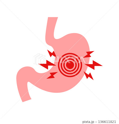 Gerd stomach icon in flat style. Reflux vector illustration on isolated background. Esophageal organ sign business concept. Gerd stomach icon in flat style. Reflux vector illustration on isolated background. Esophageal organ sign business concept. 136611821