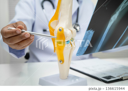 Doctor examining knee joint bone radiography xray film. Doctor examining knee joint bone radiography xray film. 136615944