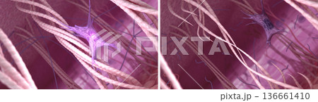 Simile of the fibroblasts, collagen, and elastin fibers in young and aged skin. 3D illustration 136661410