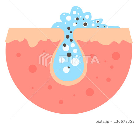 Skin pore cleansing illustration. Unclog deep sebum Skin pore cleansing illustration. Unclog deep sebum 136678355