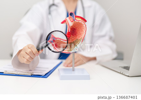Doctor with Gastric anatomy model. Gastroenterologist consultation, stomach diseases and ulcers, November stomach cancer, Gastroesophageal Reflux Disease, GERD, Acid reflux and healthcare medical 136687401