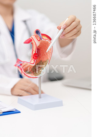 Doctor with Gastric anatomy model. Gastroenterologist consultation, stomach diseases and ulcers, November stomach cancer, Gastroesophageal Reflux Disease, GERD, Acid reflux and healthcare medical 136687466