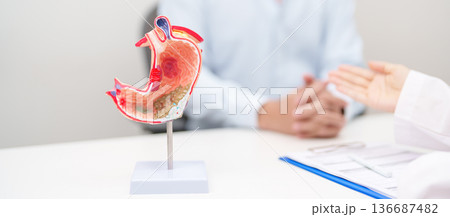 Doctor with Gastric anatomy model. Gastroenterologist consultation, stomach diseases and ulcers, November stomach cancer, Gastroesophageal Reflux Disease, GERD, Acid reflux and healthcare medical Doctor with Gastric anatomy model. Gastroenterologist consultation, stomach diseases and ulcers, November stomach cancer, Gastroesophageal Reflux Disease, GERD, Acid reflux and healthcare medical 136687482