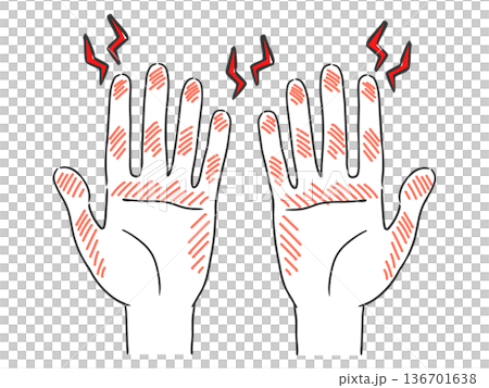 Hand care, rough hands, troubled hands, vector 136701638