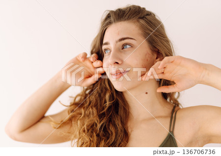 Woman no make up with red spots on her face. Health problem, skin diseases. Medicine and cosmetology Woman no make up with red spots on her face. Health problem, skin diseases. Medicine and cosmetology 136706736