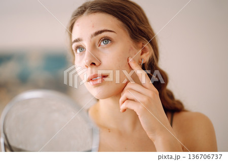 Young woman with problem skin looking into mirror. Concept of acne therapy, scars Young woman with problem skin looking into mirror. Concept of acne therapy, scars 136706737