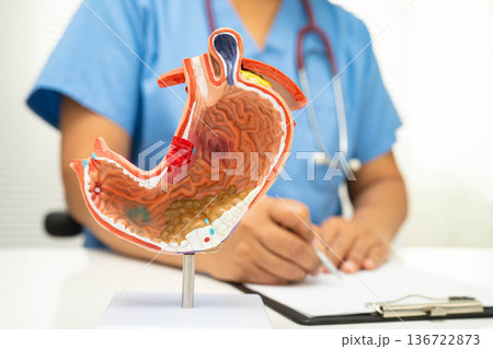 Stomach disease, doctor holding anatomy model for study diagnosis and treatment in hospital. Stomach disease, doctor holding anatomy model for study diagnosis and treatment in hospital. 136722873
