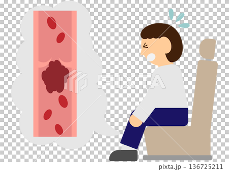 Illustration material of a man whose legs hurt from being in the same position for a long time and economy class syndrome caused by a blood clot in the venous valve 136725211
