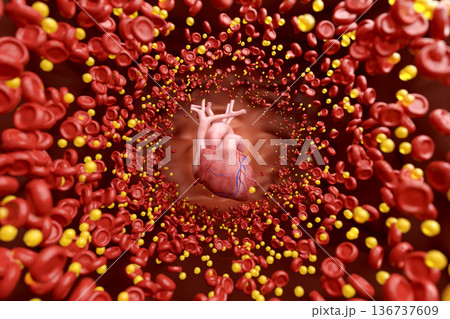 血管内のコレステロールと脂肪による動脈硬化の3Dイラスト。血液の流れと心血管疾患のコンセプト。 136737609