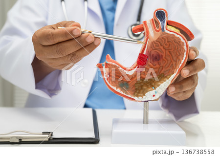 Stomach disease, doctor with anatomy model for study diagnosis and treatment in hospital. Stomach disease, doctor with anatomy model for study diagnosis and treatment in hospital. 136738558