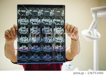 Dentist holding a panoramic dental X-ray of teeth. Dentist holding a panoramic dental X-ray of teeth. 136751400