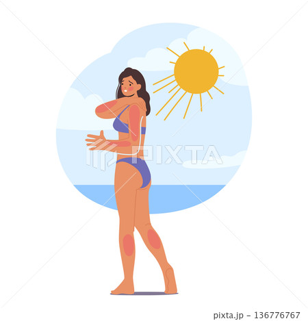 Woman Experience Skin Sunburn On Beach Due To Excessive Sun Exposure. Skin of Female Character Appears Red And Irritated 136776767