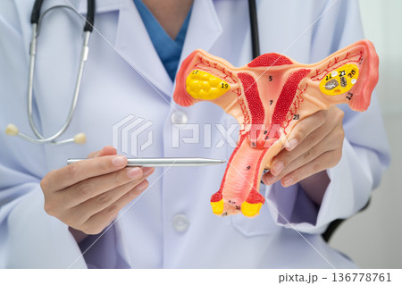 Uterus, doctor holding human anatomy model for study diagnosis and treatment in hospital. Uterus, doctor holding human anatomy model for study diagnosis and treatment in hospital. 136778761