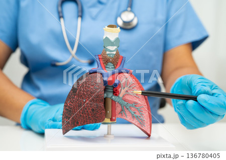 Cirrhosis, Liver cancer, fatty liver, Asian woman with liver human anatomy model. 136780405