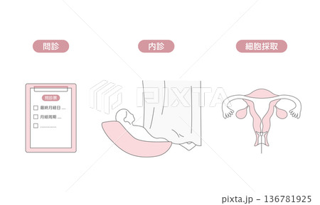 子宮頸がん検診の流れを説明する医療イラスト（問診・内診・細胞診） 136781925