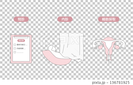 子宮頸がん検診の流れを説明する医療イラスト（問診・内診・細胞診） 136781925