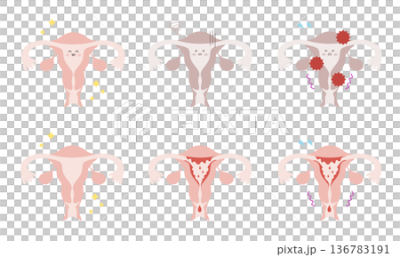 Set of uterus illustrations in various states 136783191