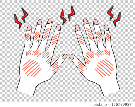 Hand care, rough hands, troubled hands, vector 136789987