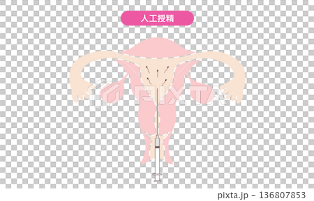 人工授精のイメージイラスト 136807853