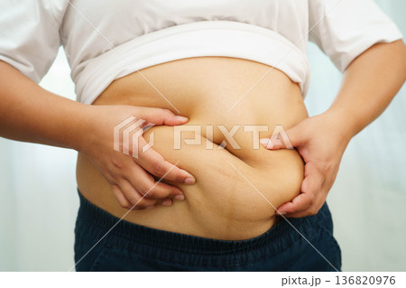 Asian woman use hand to squeeze fat belly big size overweight and obesity. Asian woman use hand to squeeze fat belly big size overweight and obesity. 136820976