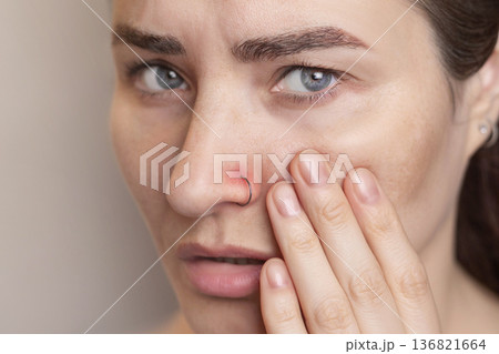 woman suffers and experiences pain from a nose piercing.. Inflamed piercing, nose after piercing. Red nose piercing site. Close up photo 136821664