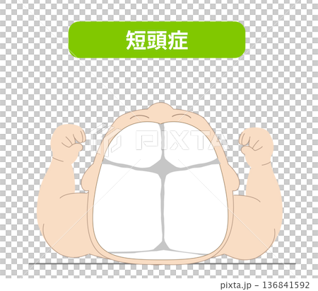 寝ている姿あ赤ちゃんが寝ている頭の向きによって頭の形に歪みが生じるメカニズム、斜頭症,短頭症,長頭症 寝ている姿あ赤ちゃんが寝ている頭の向きによって頭の形に歪みが生じるメカニズム、斜頭症,短頭症,長頭症 136841592