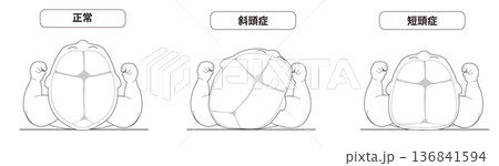 白黒線画 寝ている姿あ赤ちゃんが寝ている頭の向きによって頭の形に歪みが生じるメカニズム、斜頭症,短頭 白黒線画 寝ている姿あ赤ちゃんが寝ている頭の向きによって頭の形に歪みが生じるメカニズム、斜頭症,短頭 136841594