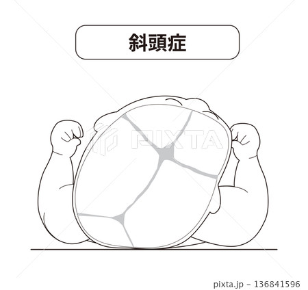 寝ている姿あ赤ちゃんが寝ている頭の向きによって頭の形に歪みが生じるメカニズム、斜頭症,短頭症,長頭症 寝ている姿あ赤ちゃんが寝ている頭の向きによって頭の形に歪みが生じるメカニズム、斜頭症,短頭症,長頭症 136841596