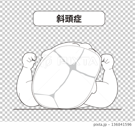 寝ている姿あ赤ちゃんが寝ている頭の向きによって頭の形に歪みが生じるメカニズム、斜頭症,短頭症,長頭症 寝ている姿あ赤ちゃんが寝ている頭の向きによって頭の形に歪みが生じるメカニズム、斜頭症,短頭症,長頭症 136841596