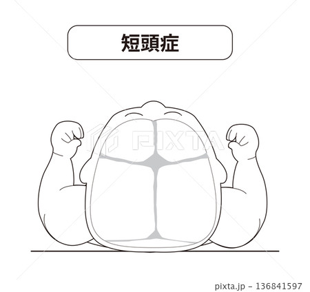 寝ている姿の赤ちゃんが寝ている頭の向きによって頭の形に歪みが生じるメカニズム、斜頭症,短頭症,長頭症 寝ている姿の赤ちゃんが寝ている頭の向きによって頭の形に歪みが生じるメカニズム、斜頭症,短頭症,長頭症 136841597