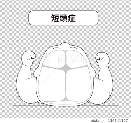 寝ている姿の赤ちゃんが寝ている頭の向きによって頭の形に歪みが生じるメカニズム、斜頭症,短頭症,長頭症 寝ている姿の赤ちゃんが寝ている頭の向きによって頭の形に歪みが生じるメカニズム、斜頭症,短頭症,長頭症 136841597