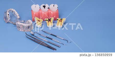 Dental education models with caries tooth cross sections and instruments on blue background 136850959