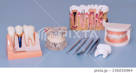 Dental implant and tooth anatomy training models with dentist instruments on blue background Dental implant and tooth anatomy training models with dentist instruments on blue background 136850964