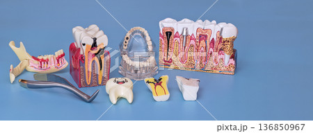 Dental education models with tooth decay cross sections, jaw anatomy and extraction tool on blue background 136850967